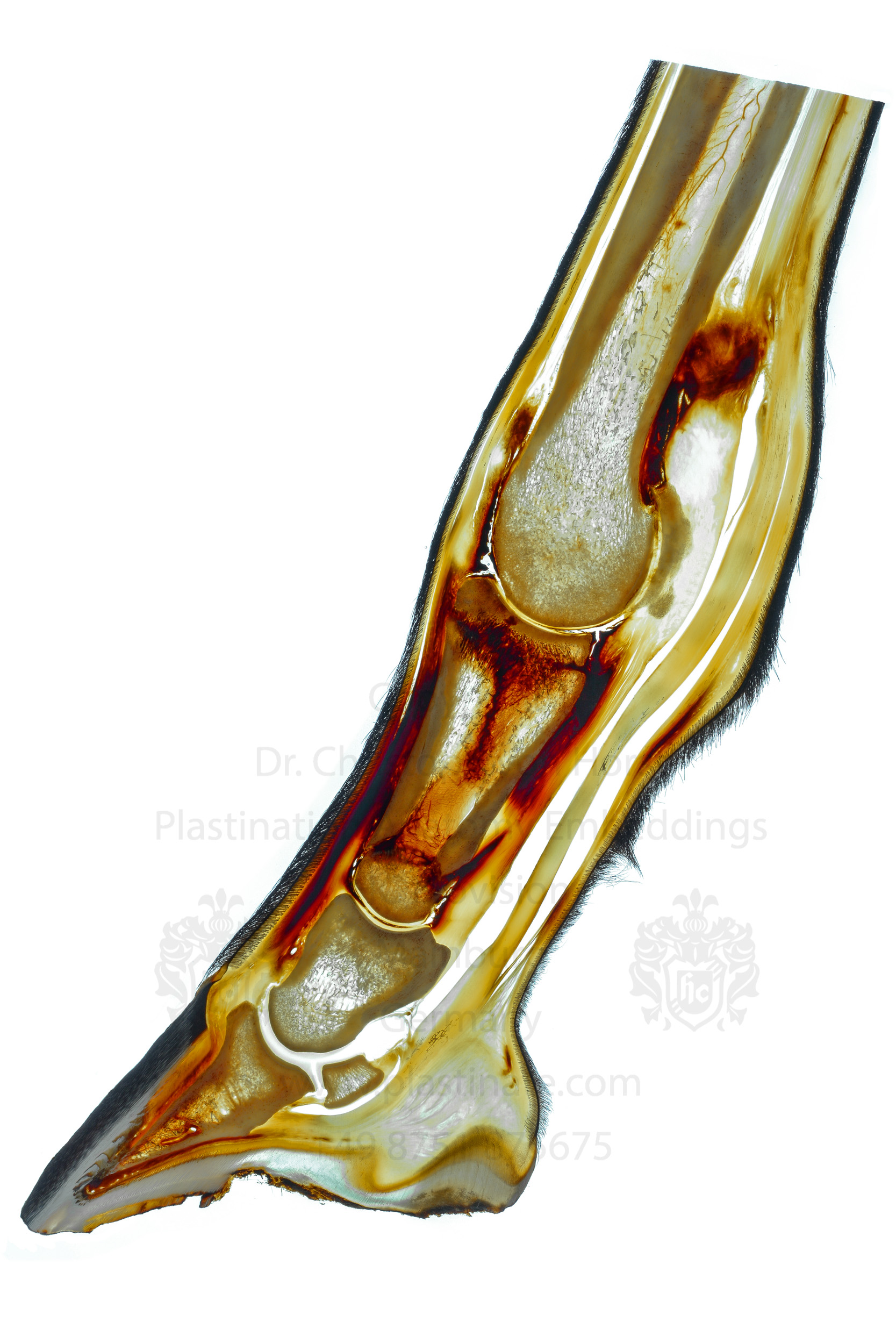 1051