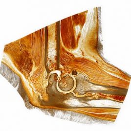 Dog elbow joint pathology print