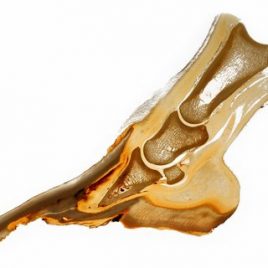 Pathologie Hufrehe lange Zehe