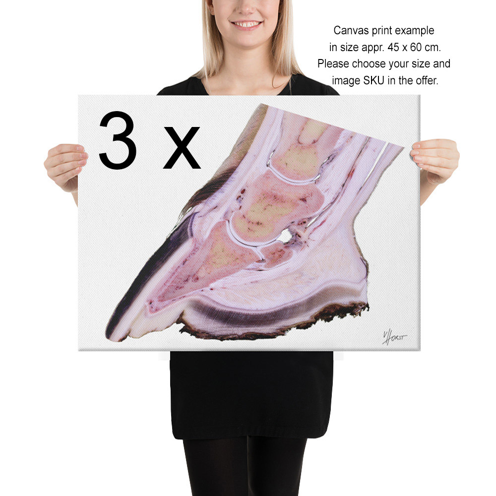 3-package-30238_Person_45x60