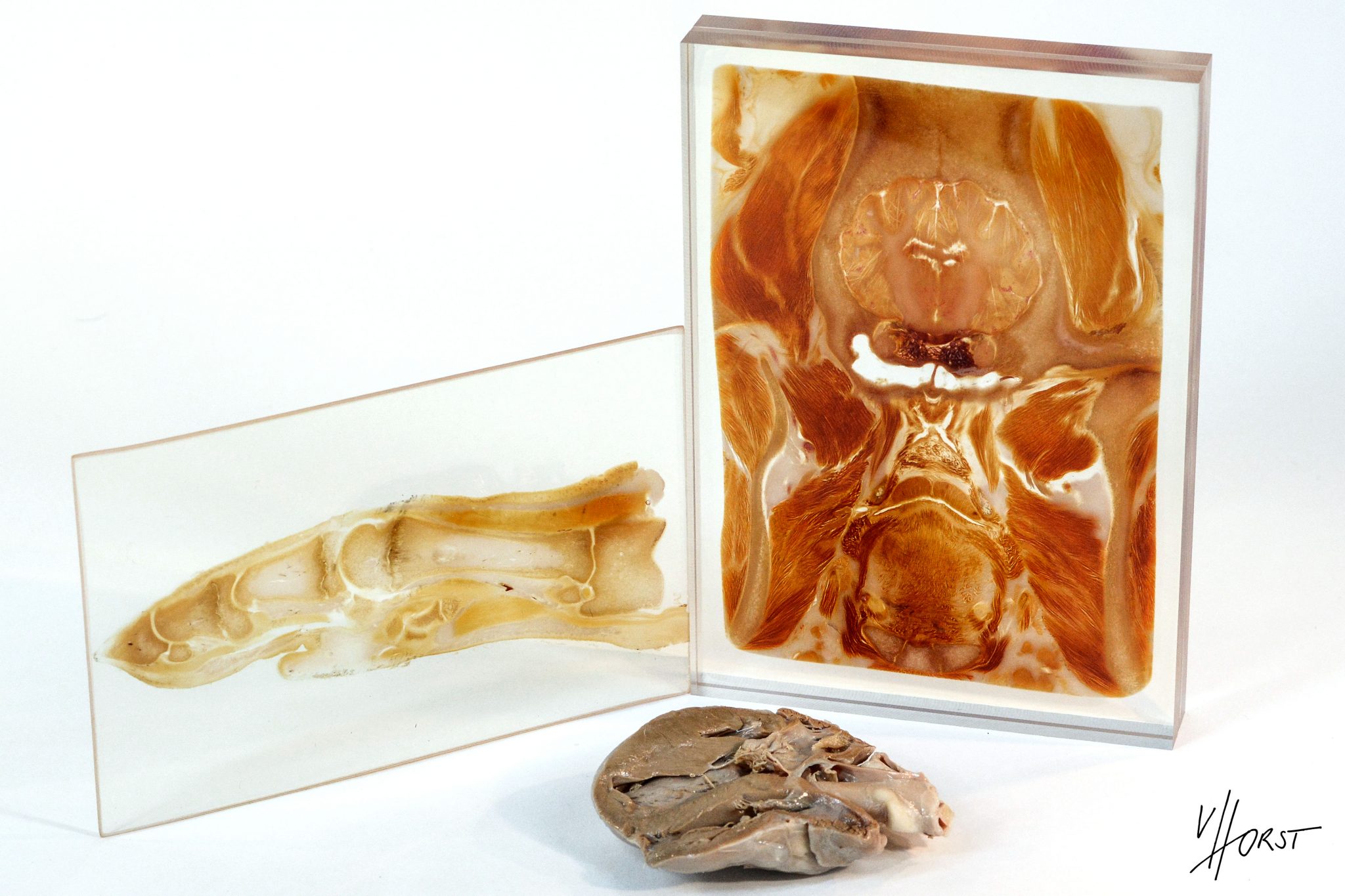 Probepaket PlastinateEinblicke Plastination Anatomy Embedding