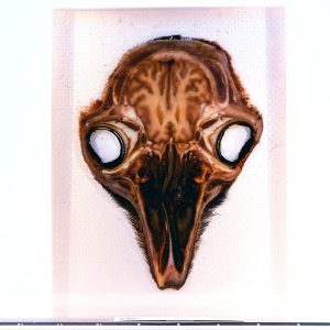 Brain_nervous_tissue_plastination